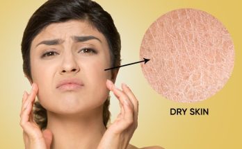 What do you know about dry skin problems in this cold season?