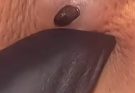 Deep DPOW extraction – Dilated Pore of Winer extraction – ChangYing Spa