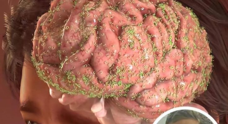 Man Ate a Slug After Being Dared by His Friends Leading to a Tragic End