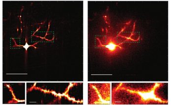 Microscope system sharpens scientists’ view of neural circuit connections