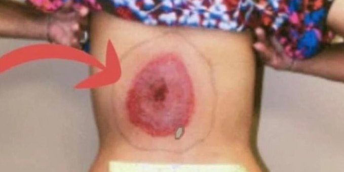 10 deadliest insects: Discover the world’s most dangerous insects to humans