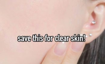 5 easy tips to maintain healthy skin