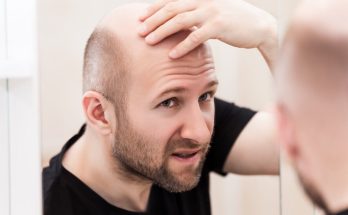 Intermittent fasting surprisingly linked to stunted hair growth