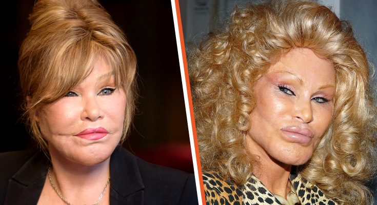 How ‘Catwoman’ Jocelyn Wildenstein Would Look If She Never Changed Her Appearance – Photos via AI
