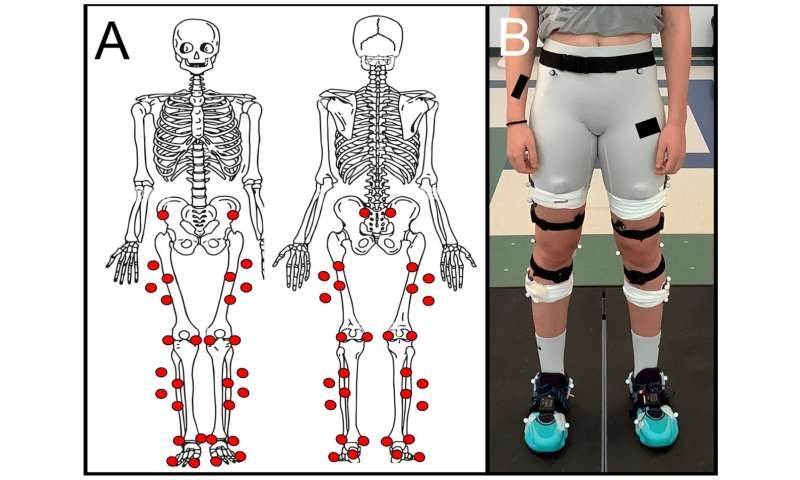 Exploring foot biomechanics using a women’s basketball team