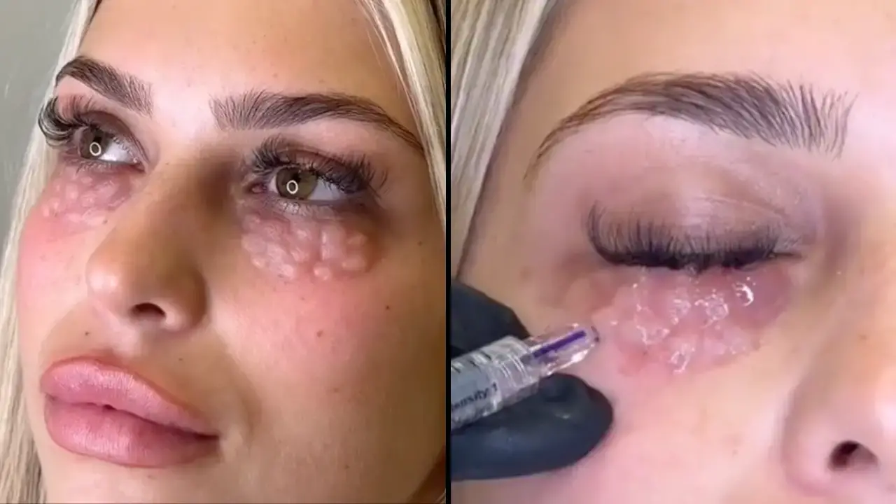 Doctor Warns Against Dangerous New Trend That Leaves People Looking Like ‘Reptiles’