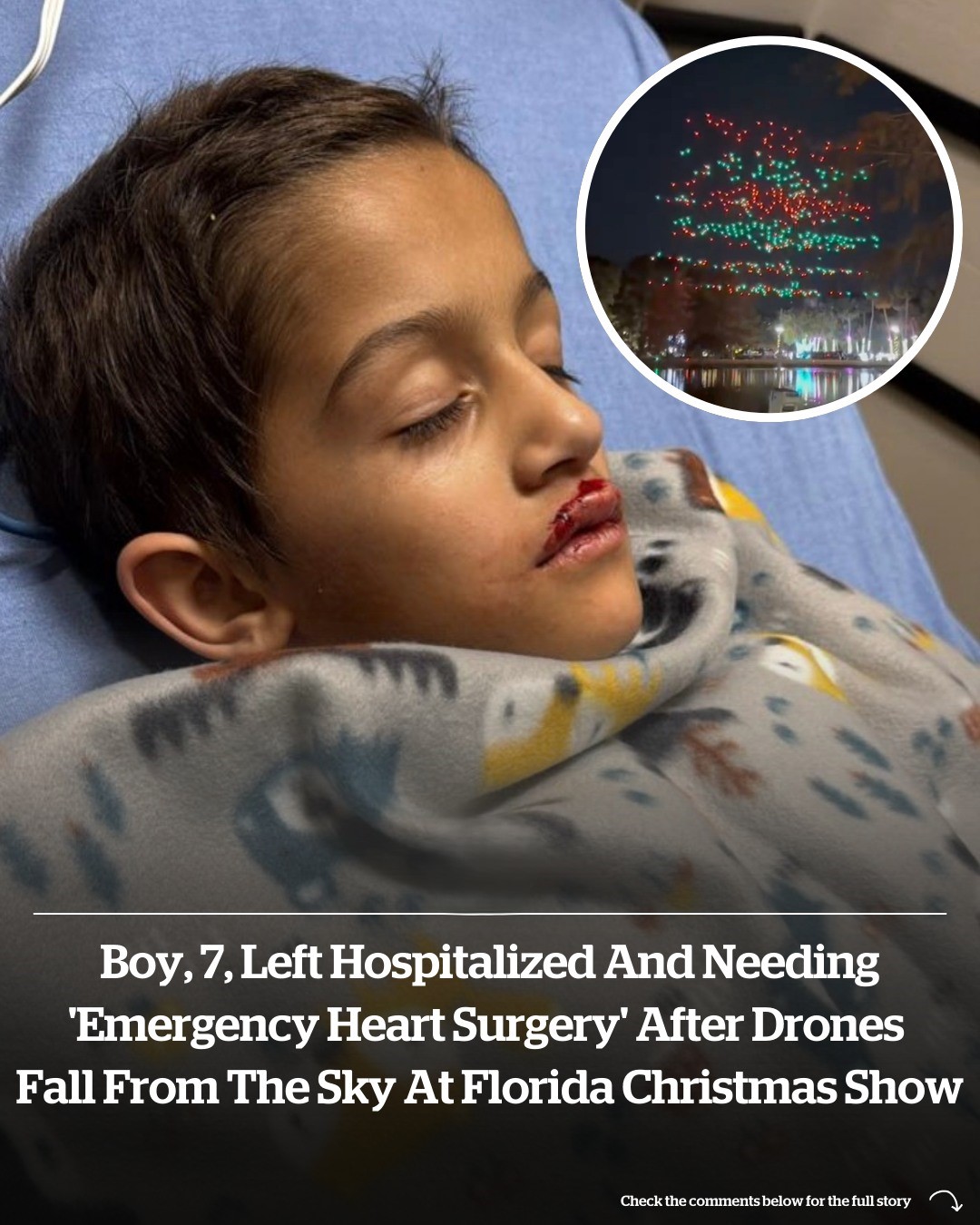 Boy, 7, left hospitalized and needing 'emergency heart surgery' after drones fall into crowd at Florida Christmas show