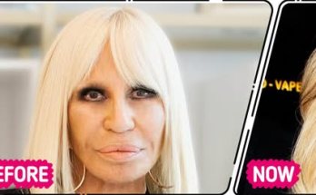 “That Surgeon Needs a Nobel Prize!” New Look of Donatella Versace Creates Online Stir