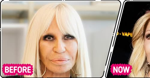 “That Surgeon Needs a Nobel Prize!” New Look of Donatella Versace Creates Online Stir