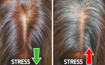 6 Causes of Early Graying You Never Suspected