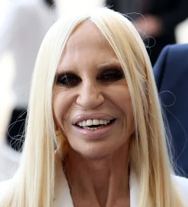 Donatella Versace Debuts with a “NEW FACE” — She Looks Unrecognizable!