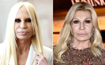 Donatella Versace, 69, stuns with new youthful appearance