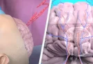 'Worst nightmare' simulation shows how woman got a 3-inch worm in her brain after eating vegetables