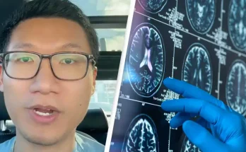 Doctor reveals easy 2-minute tests that could explain if you have early signs of dementia
