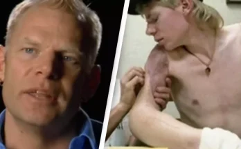 Man who lost both of his arms in accident managed to get them reattached after calling 911 with a pencil