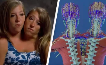 Incredible simulation shows conjoined twins Abby and Brittany Hensel's 'unique' anatomies and how they function