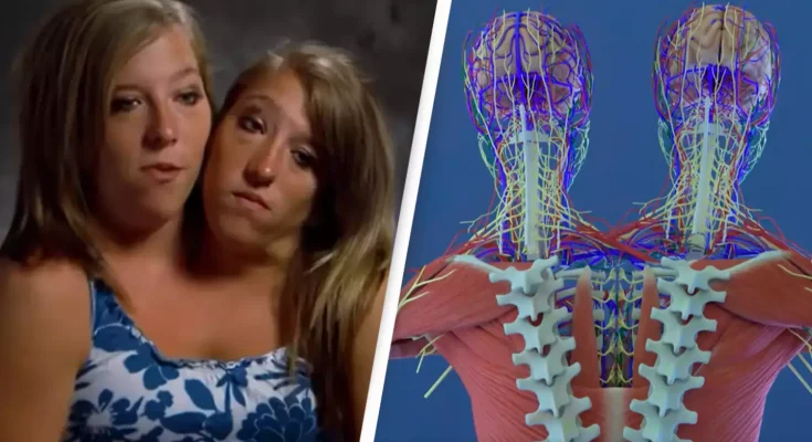 Incredible simulation shows conjoined twins Abby and Brittany Hensel's 'unique' anatomies and how they function