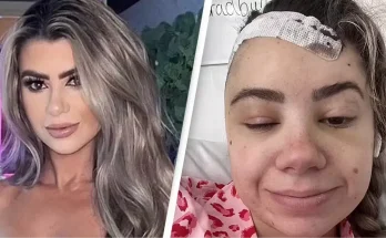 Woman dismissed by doctors for 'migraines' shares shocking diagnosis after begging for MRI scan