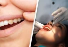 Dentist reveals common mistake people make that causes yellow teeth and how to avoid it