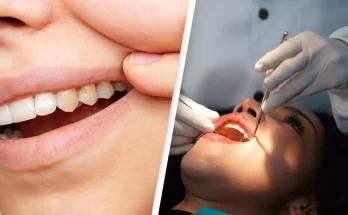 Dentist reveals common mistake people make that causes yellow teeth and how to avoid it