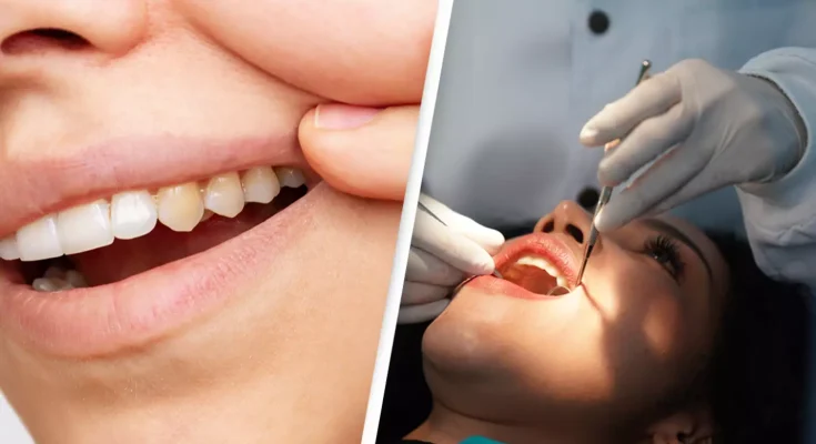 Dentist reveals common mistake people make that causes yellow teeth and how to avoid it