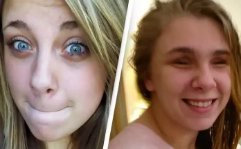 Woman who ripped out her own eyes explains how her ‘mind will not accept not seeing’