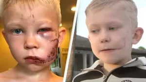 Boy hailed hero after risking his life to save sister from brutal dog attack