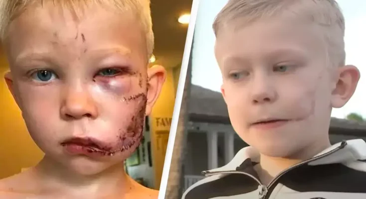 Boy hailed hero after risking his life to save sister from brutal dog attack
