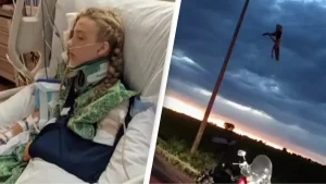Teen left hanging from power line by broken leg speaks out on gruesome way she survived