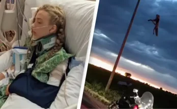 Teen left hanging from power line by broken leg speaks out on gruesome way she survived