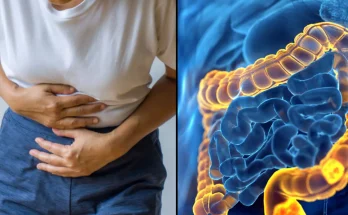Experts suggest main reasons why certain cancer type is rising in young people worldwide