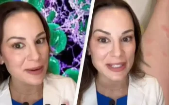 Expert reveals gross reason why mosquitoes like some people a lot more than others