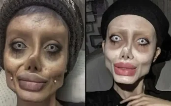 ‘Zombie’ Angelina Jolie Lookalike Shows Off Real Face After Release From Prison