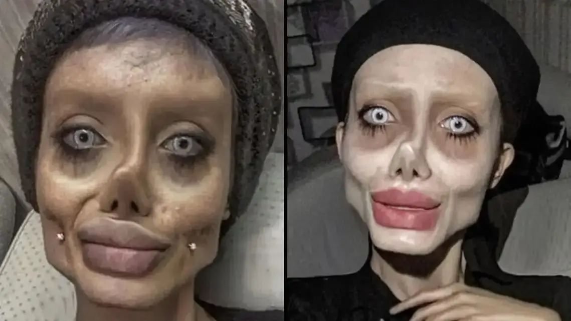 ‘Zombie’ Angelina Jolie Lookalike Shows Off Real Face After Release From Prison