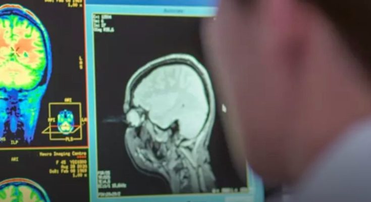 Specialist discusses brain changes when you quit social media