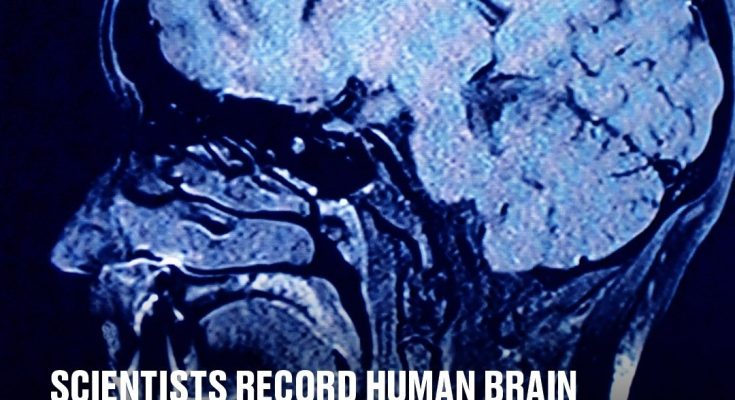 Scientists record human brain as someone dies and make incredible revelation The scientists say the findings 'challenge our understanding of when exactly life ends'