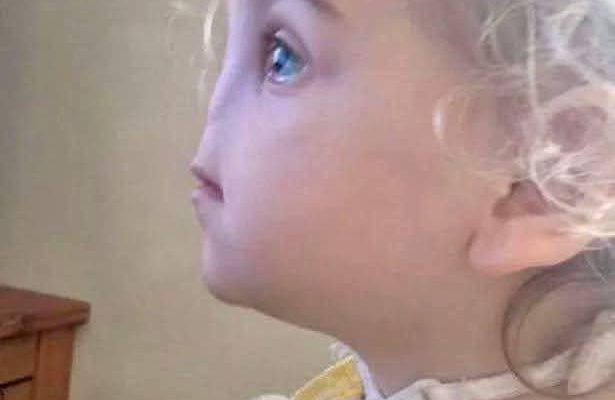Tessa Evans’ Rare Condition: Overcoming Challenges and Inspiring Change