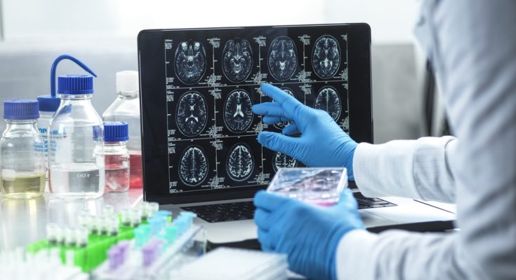 Man diagnosed with dementia aged 49 shares subtle change at work that made him realize something was wrong