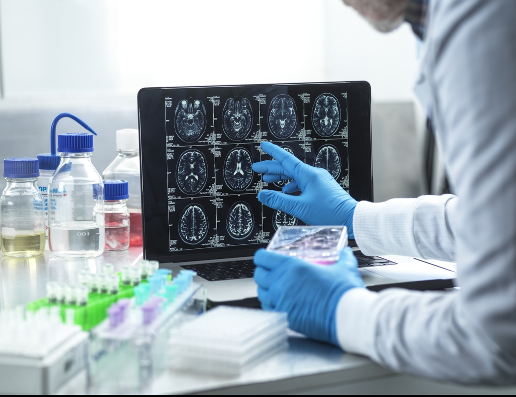 Man diagnosed with dementia aged 49 shares subtle change at work that made him realize something was wrong