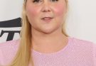 Amy Schumer says comments on her 'moon face' led to her being diagnosed with rare disorder