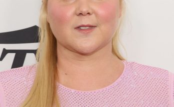 Amy Schumer says comments on her 'moon face' led to her being diagnosed with rare disorder