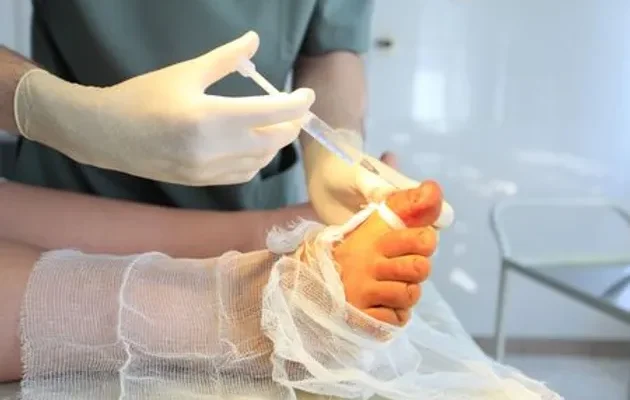DEEPEST and LONGEST INGROWN NAIL REMOVED