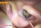 Do you believe his earwax is nearly 2 months old? – asmr-Earwax