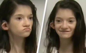 Incredible footage shows deaf girl hearing for first time with a brainstem implant