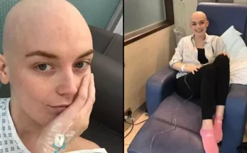 Woman in her 20s shares three cancer symptoms she ignored before getting stage four diagnosis