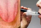 Expert reveals shocking long-term side effect of ‘Vaper’s Tongue’ that will put many people off