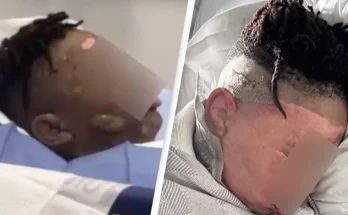 Young boys facing charges after 'dumping scalding water on friend' in sleepover prank