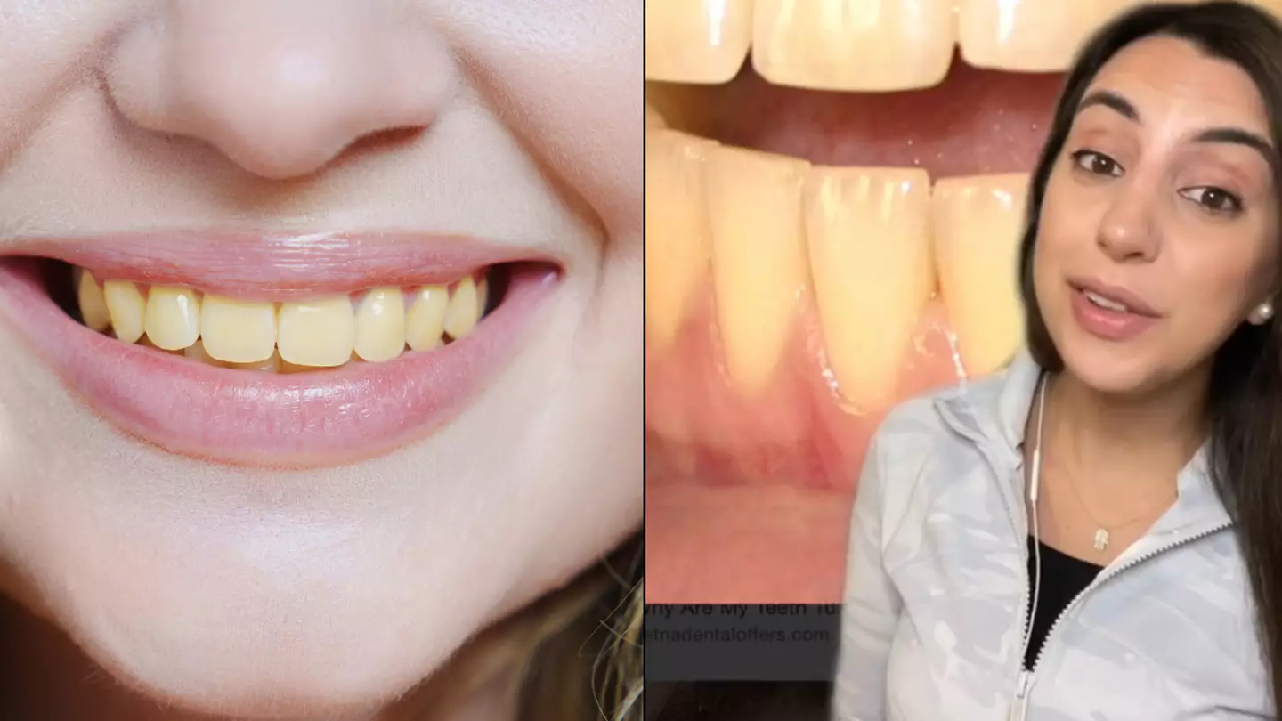 Dentist explains reason your teeth are yellow even though you 'always brush them'