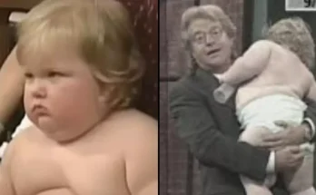 Effects of rare genetic condition ‘70lb’ Jerry Springer Show baby had after it was revealed what he looks like now