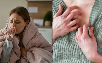 Doctor reveals HMPV illness warning sign you must look out for on your skin